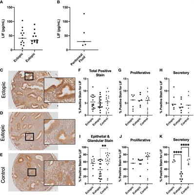 Frontiers The Dysregulation Of Leukemia Inhibitory Factor And Its